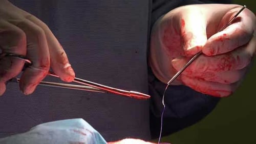 Surgical Suture Or Stitches 2