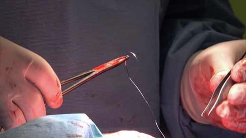 Surgical Suture Or Stitches 6