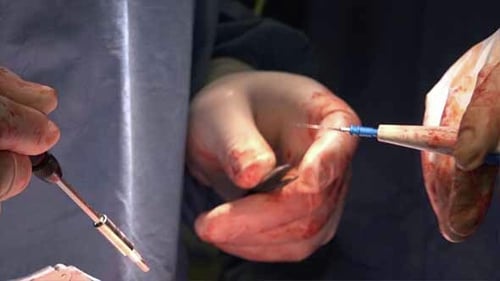 The Medical Practice or Technique of Cauterization