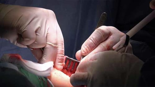 Surgical Procedure Close-Up in an Operating Room