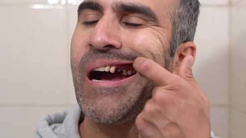 Tooth loss.
