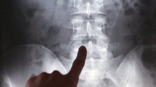 Doctors Regard Chest X-ray