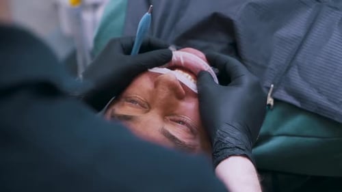 Close-up Dental Surgery for Man