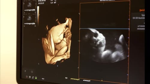 Image of the Child Displaying Ultrasound in the Clinic