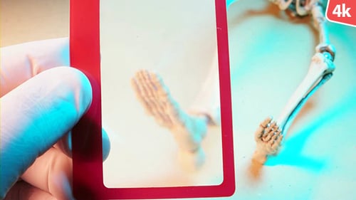 Magnified Skeletal Foot Analysis in a Laboratory