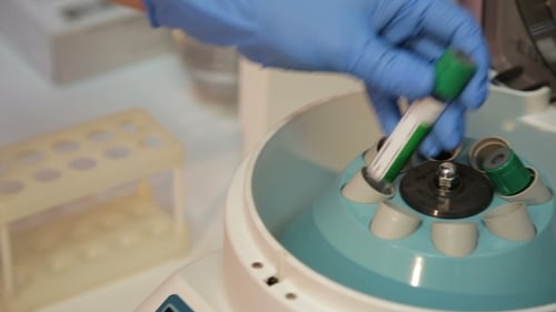 Terapia con plasma rico en plaquetas.