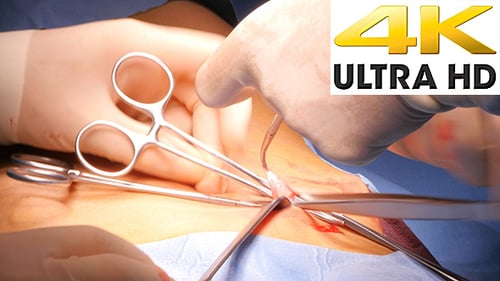 Operation und Gesamtansicht im Krankenhaus