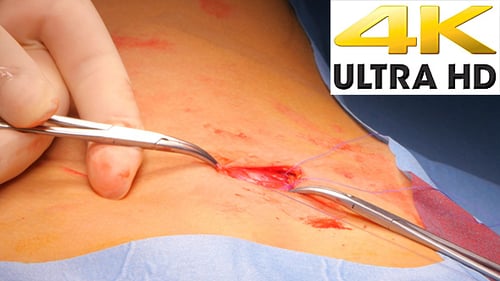 Surgery Operation and General View in Hospital