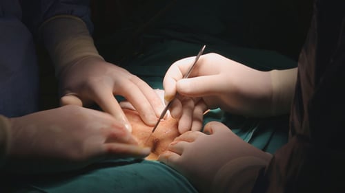 Surgeons Performing Surgical Procedure in Operating Room