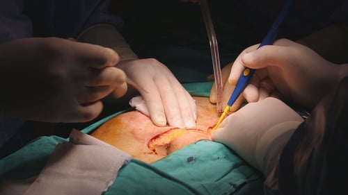 Close-up of Surgical Operation with Surgical Instruments