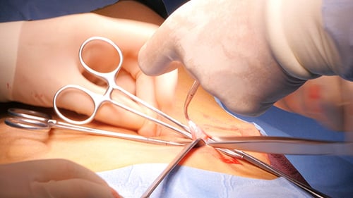 Operation und Gesamtansicht im Krankenhaus