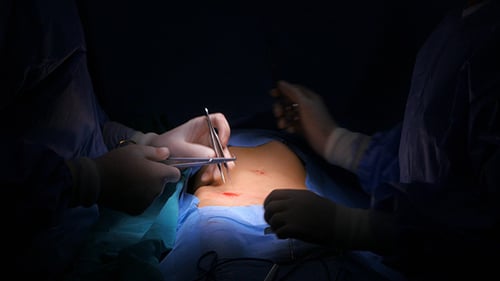 Operation und Gesamtansicht im Krankenhaus