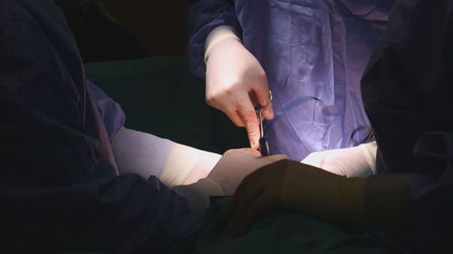 Surgical Team Performing Operation in Sterile Environment