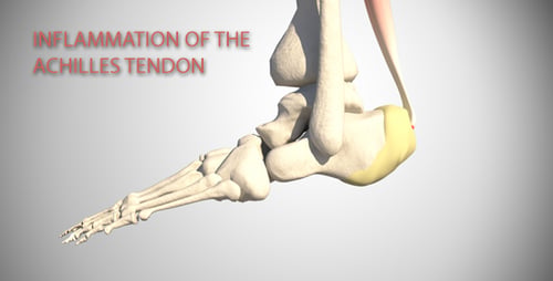 Achilles Tendon Anatomy on Heel Bone 3D Animation