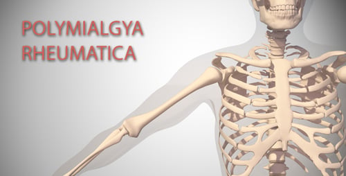 Polymialgya Rheumatica