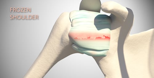 3D Human Shoulder Joint Anatomy with Injury Animation