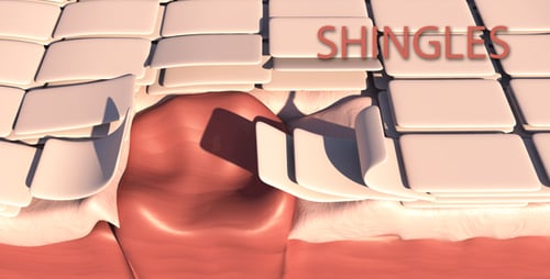 Detailed 3D Medical Animation of Skin Layers Peeling