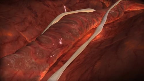 Futuristic Medical Animation of Blood Flow in Artery