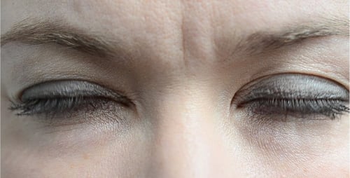 Augen 14