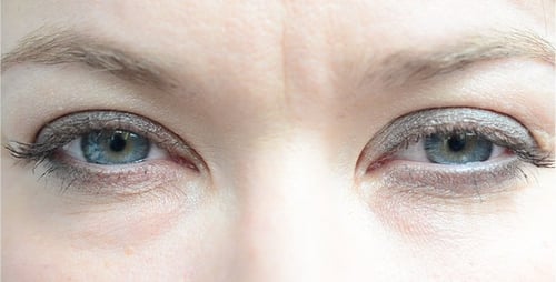 Eyes 18