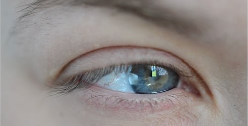 Augen 31