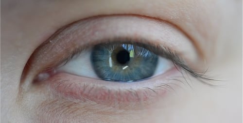 Augen 35