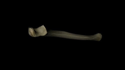 3D Human Long Bone Rotating Animation