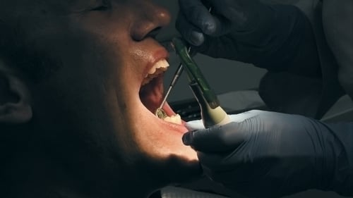 Adult Man Having Teeth Cleaned by Dentist