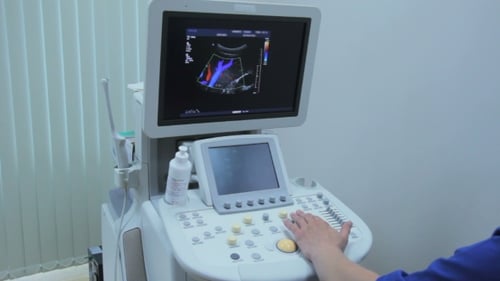Modern Ultrasound Machine Used for Medical Imaging