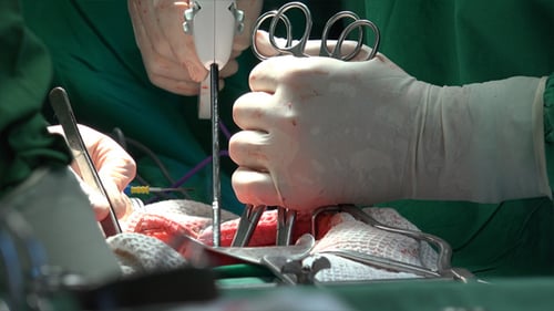 Surgeons Performing Delicate Operation in Hospital Setting