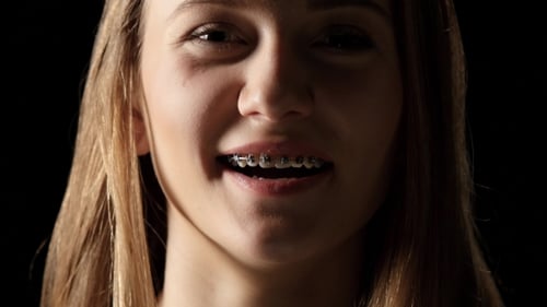 Teen Smiling, Showing Braces, Dark Background, Close Up