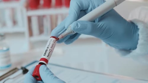 Marking Blood Test Tube in the Lab