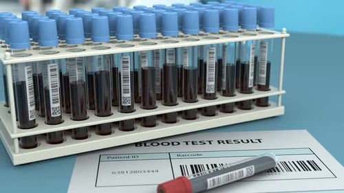 Animated Blood Test Result Form with Medical Test Tubes