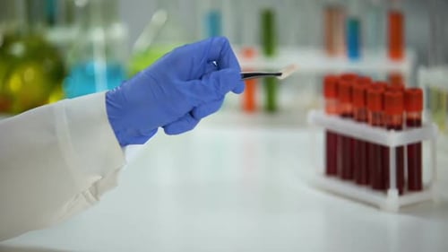 Blood Sample Examined in a Lab