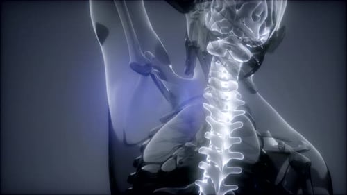 Backache in Back Bones