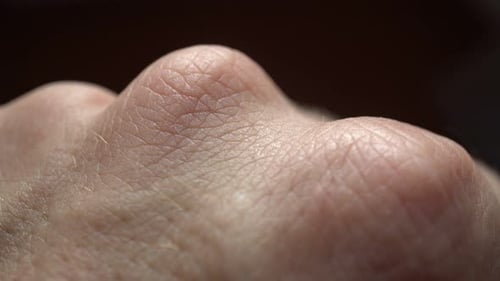 Fondo de piel humana macro