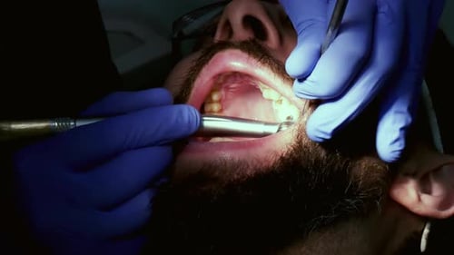Dentist Working on Patient's Teeth Close Up
