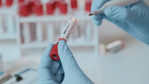 Close Up of Tube with Positive Test SARS-CoV-2 in Hands