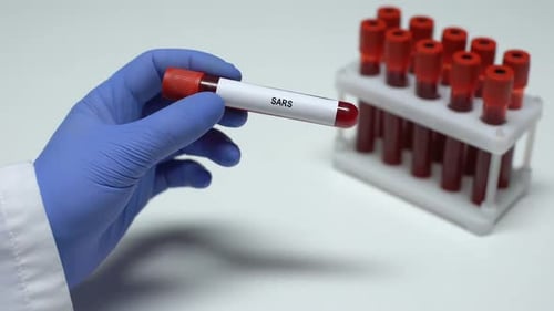 Gloved Hand Holding Test Tube Labeled SARS
