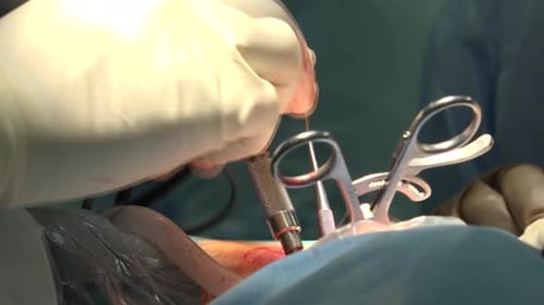 Surgical Procedure Close Up In Hospital Operation Room