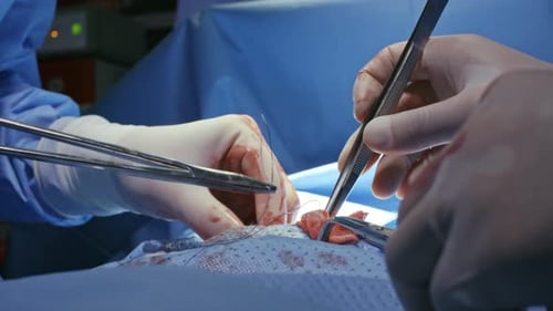 Hands of Surgeons Stitching Patient