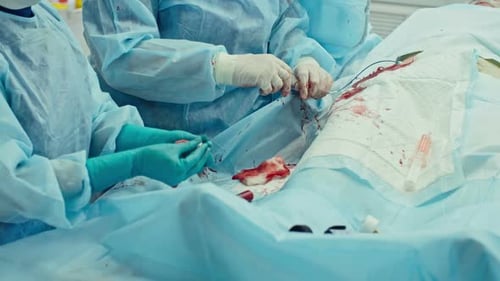 Bloody Bypass Surgery
