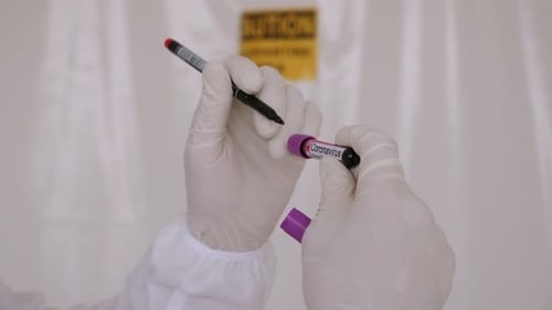 Coronavirus Blood Sample Analysis in Lab