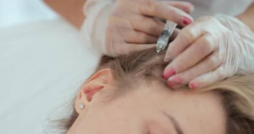 Injection into Woman's Scalp at Clinic