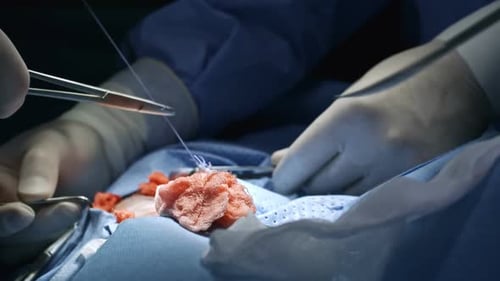 Surgeons Hands Stitching Patient