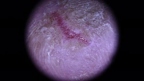 Close Up of Injured Human Finger with Wound