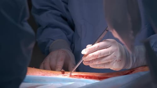 Surgeons Suturing Incision in Operating Room