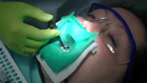 Closeup Inserting Protaper in Root Canal of Patient in Dental Chair