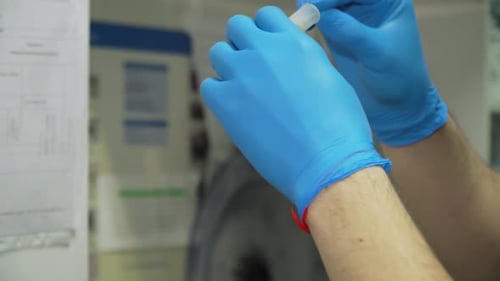 Urine Analysis in the Laboratory