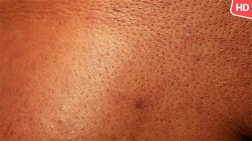 Human Skin 0396